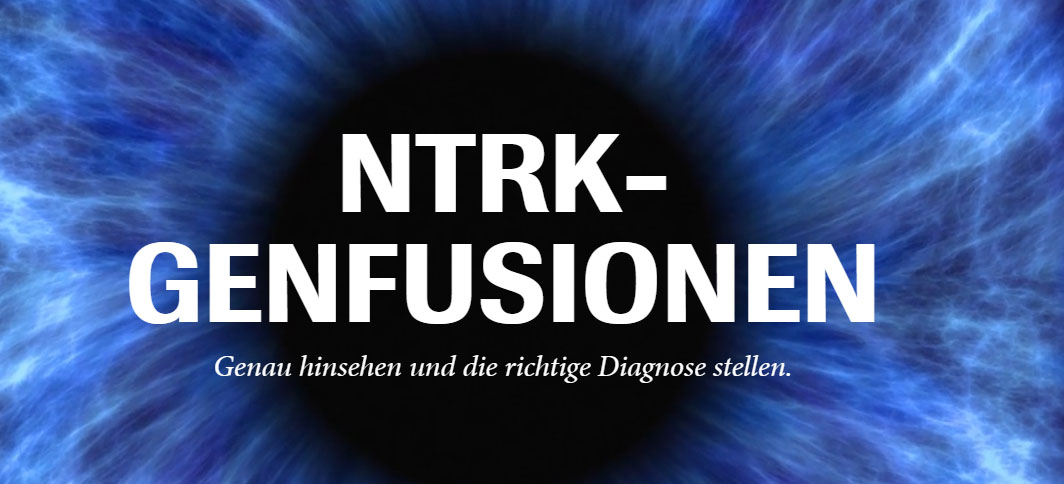NTRK-Genfusionen